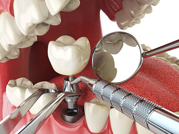 Best Emergency Dentist for Special Needs Patients in Winchester, MO